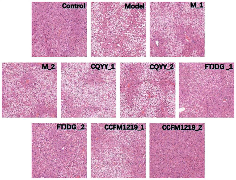 Fatty liver and obesity relieving metaplasm prepared from lactobacillus rhamnosus and application of metaplasm