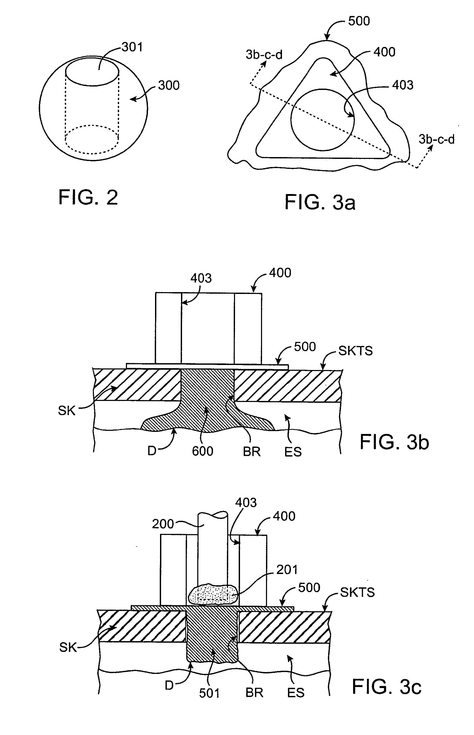 Methods and systems for ultrasound delivery through a cranial aperture