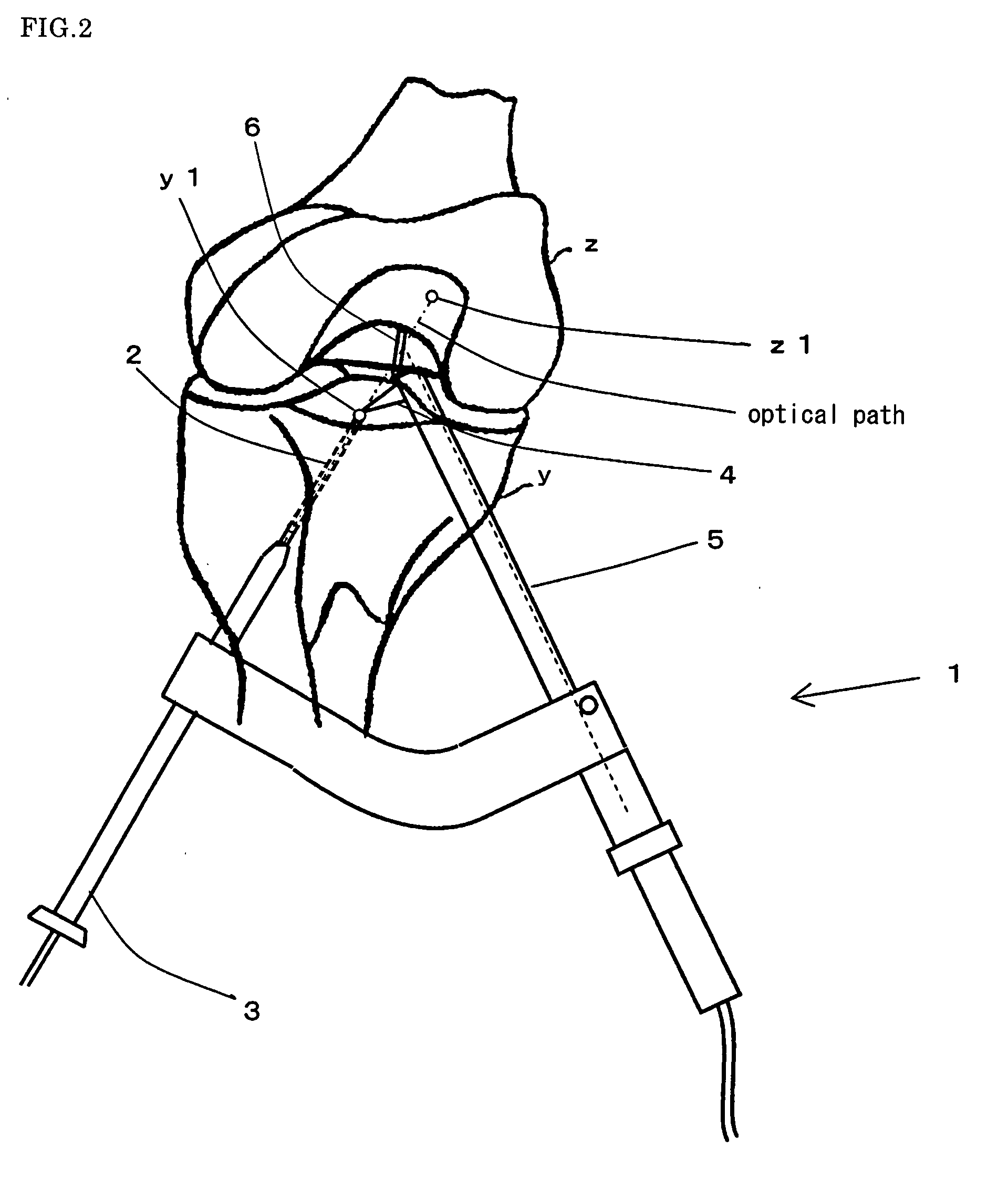 Drill guide for anterior cruciate ligament reconstruction operation