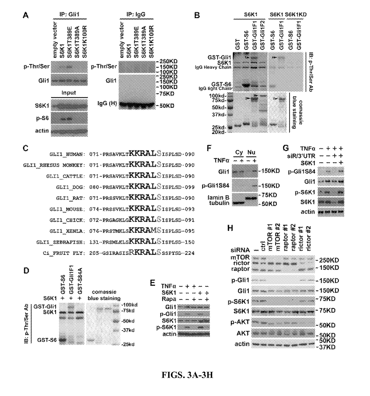 Personalized medicine for the prediction of therapy targeting the hedgehog pathway