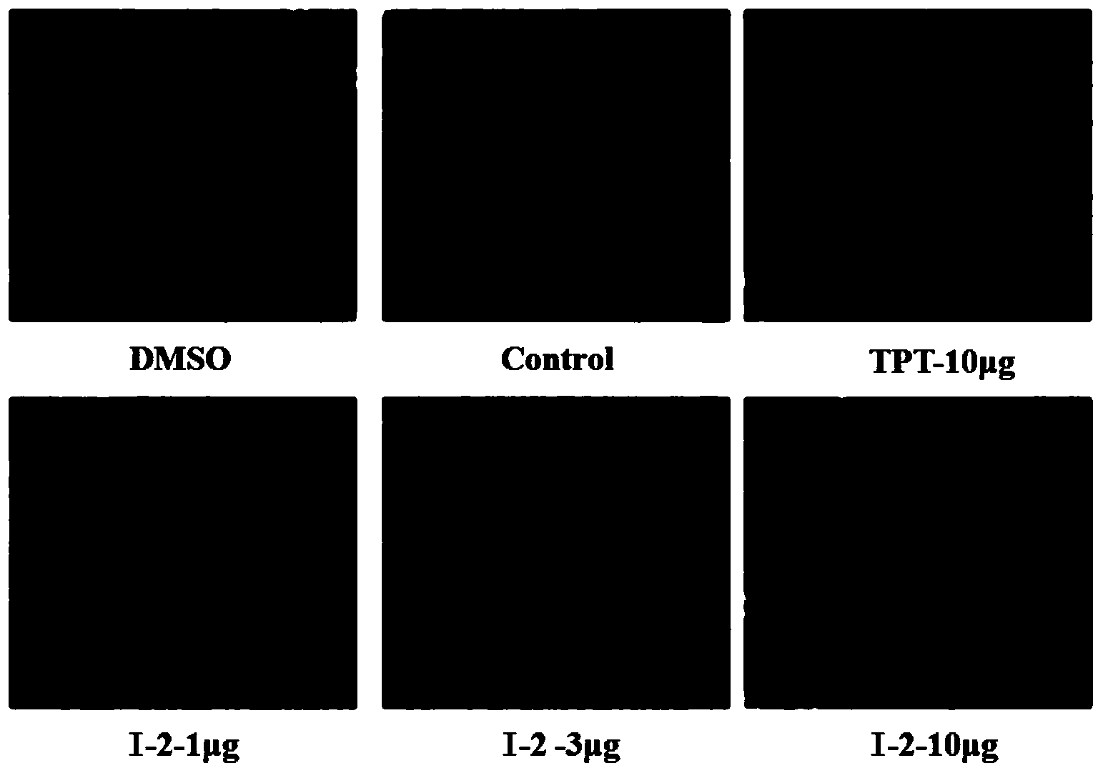 N-(2-deoxy-lactose-2-group)-3-(substituted phenyl) acrylamide and medical application thereof