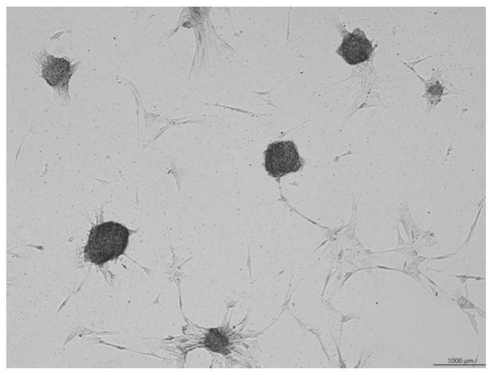 A kind of inducer of stem cell differentiation into chondrogenic and its application