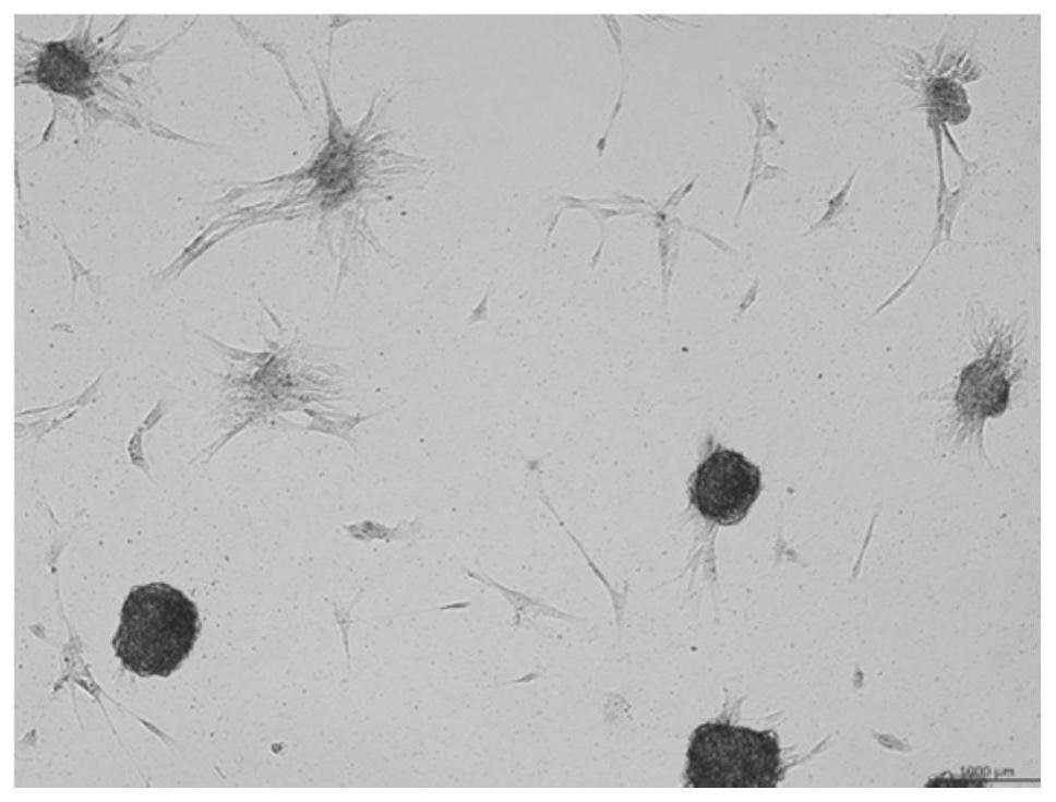 A kind of inducer of stem cell differentiation into chondrogenic and its application