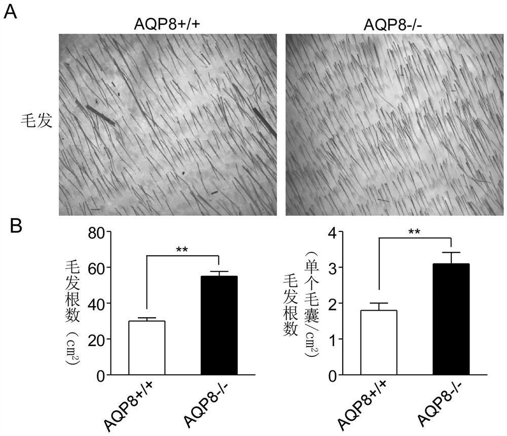 Method for increasing number of skin hair and accelerating hair growth speed