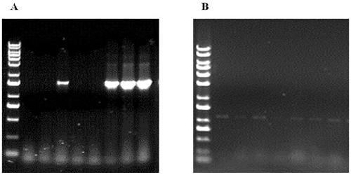 Recombinant poxvirus containing ccl5 and sstr2 genes and preparation method thereof
