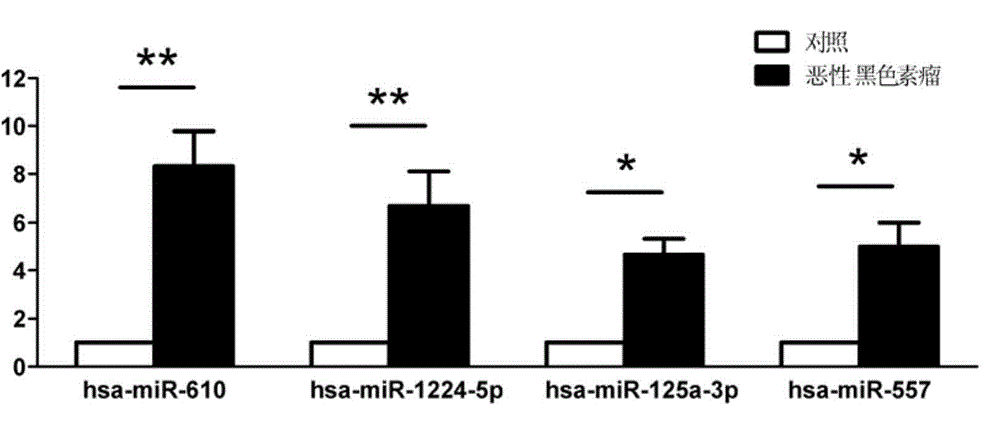 Plasma/serum circulation microRNA marker related to mlignnt melnom and application of marker