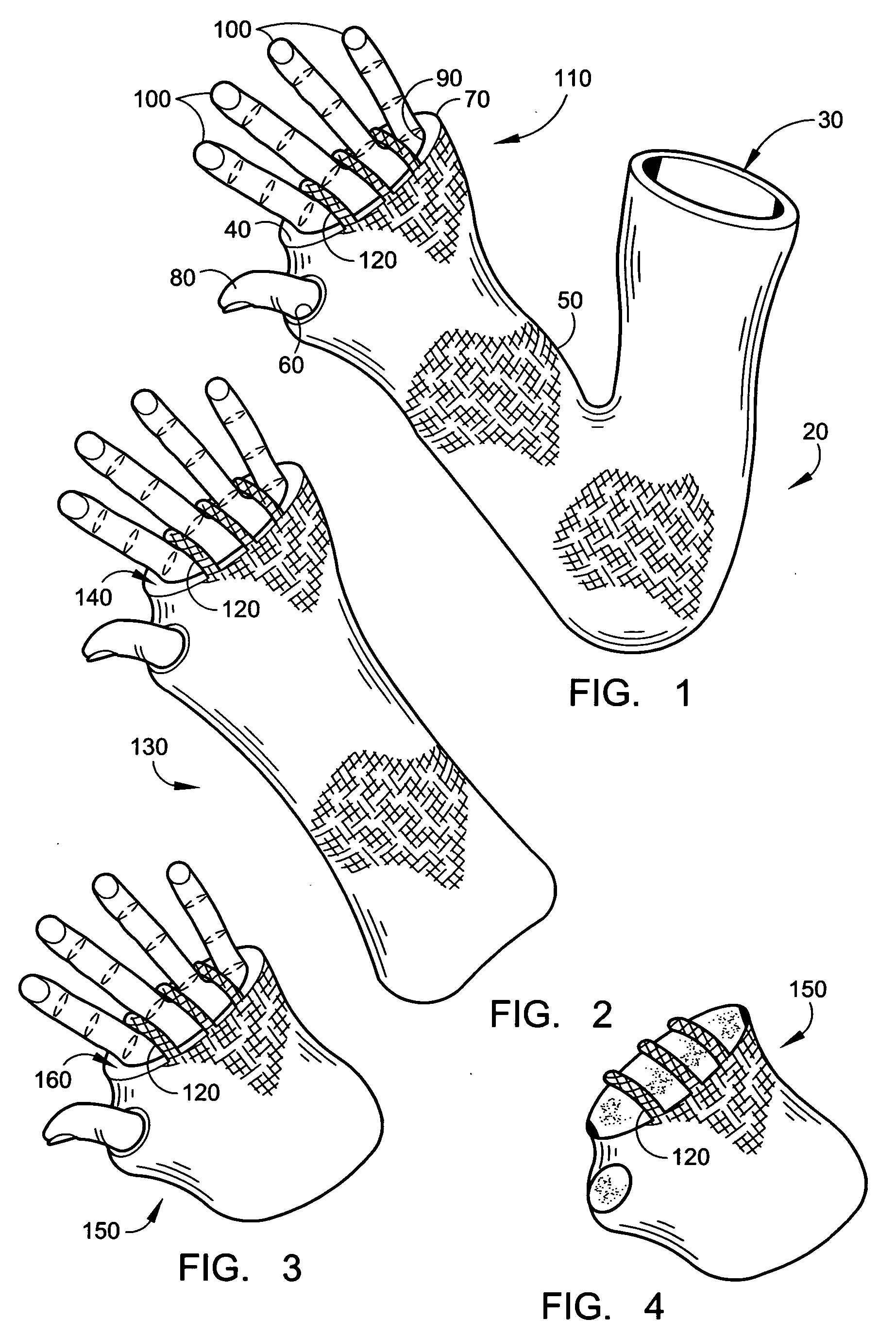 Cast cover and method of use
