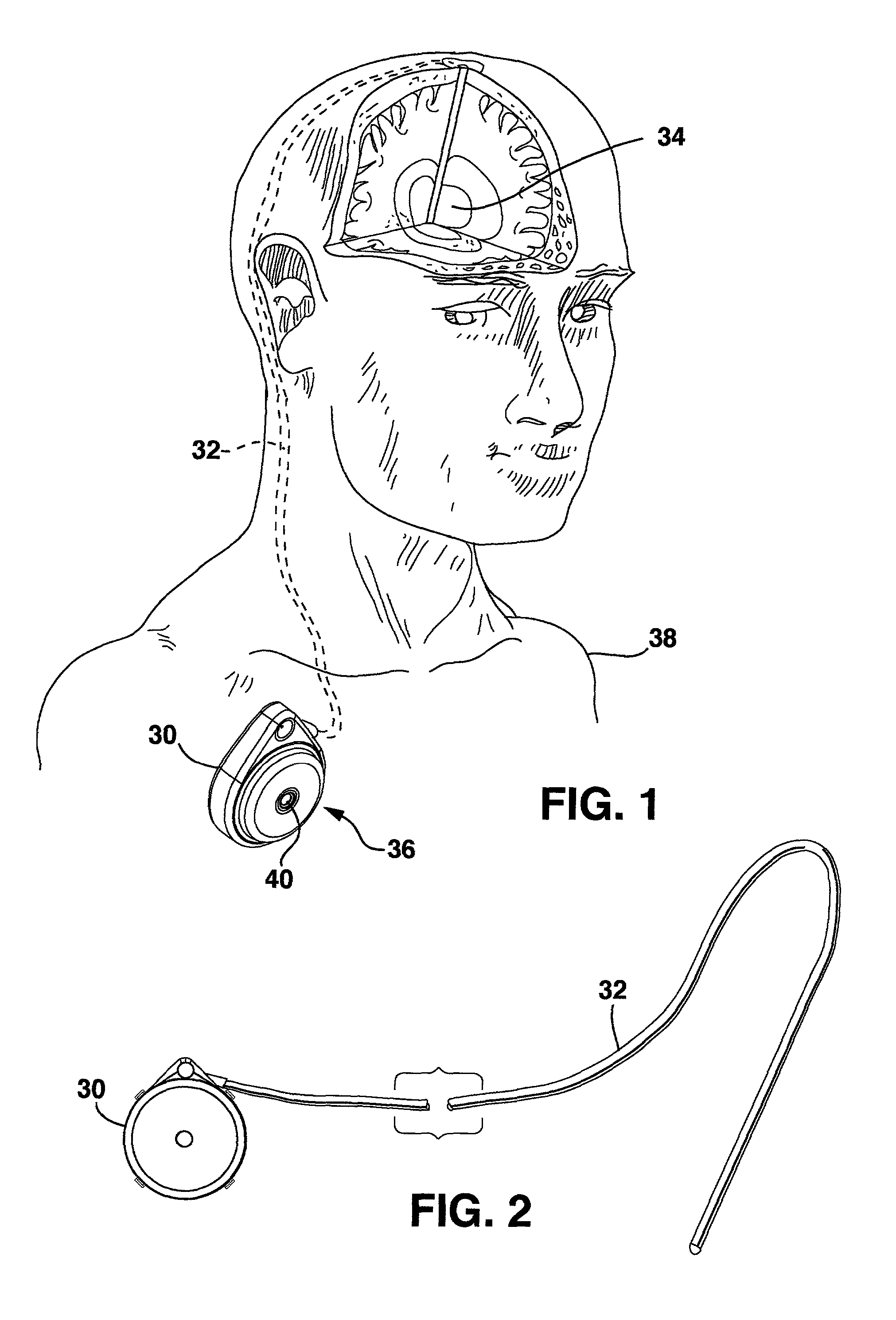 Permanent magnet solenoid pump for an implantable therapeutic substance delivery device