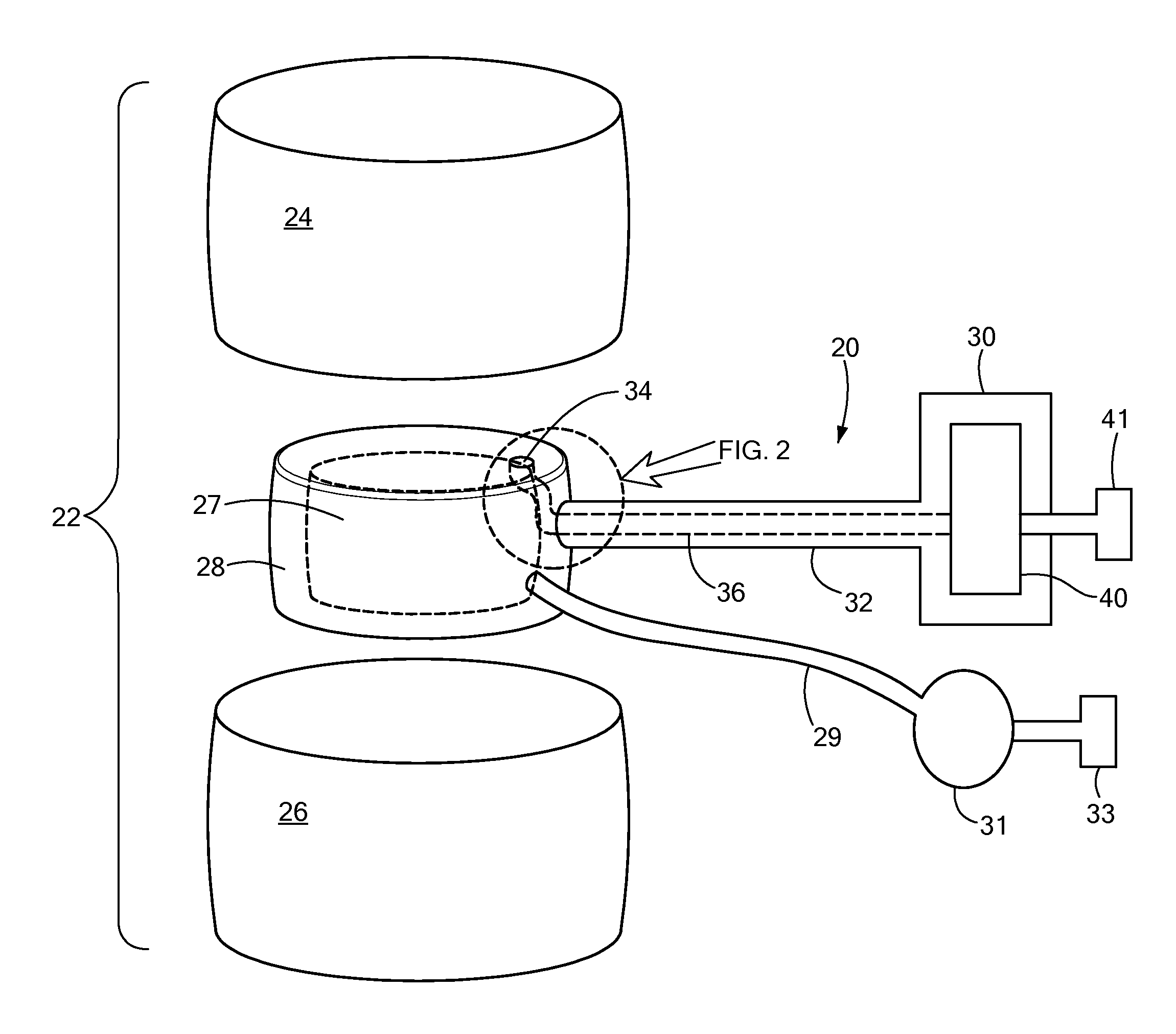 Drug Delivery Device and Method