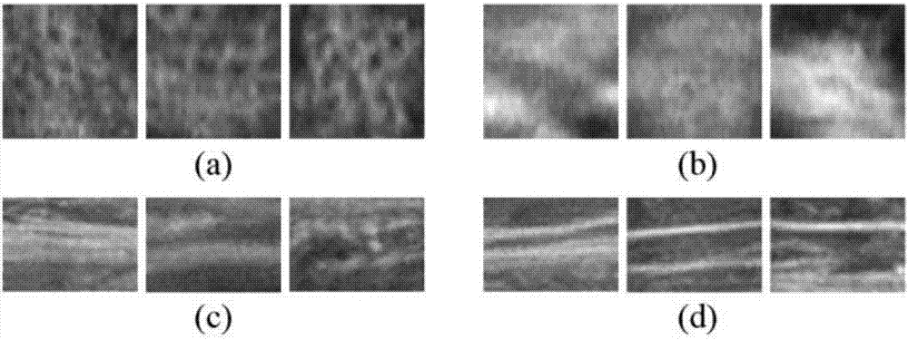 Lightweight incisional hernia patch three-dimensional ultrasonic image feature extraction method