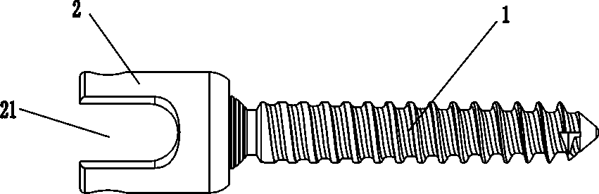 A pedicle screw