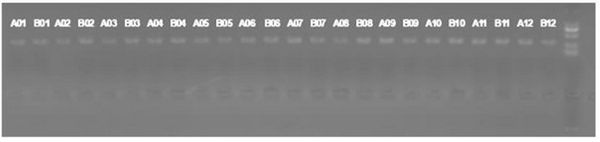 ENO1 gene promoter region methylation site and application thereof in preparation of kit for early diagnosis and prognosis evaluation of esophageal cancer