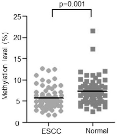 ENO1 gene promoter region methylation site and application thereof in preparation of kit for early diagnosis and prognosis evaluation of esophageal cancer