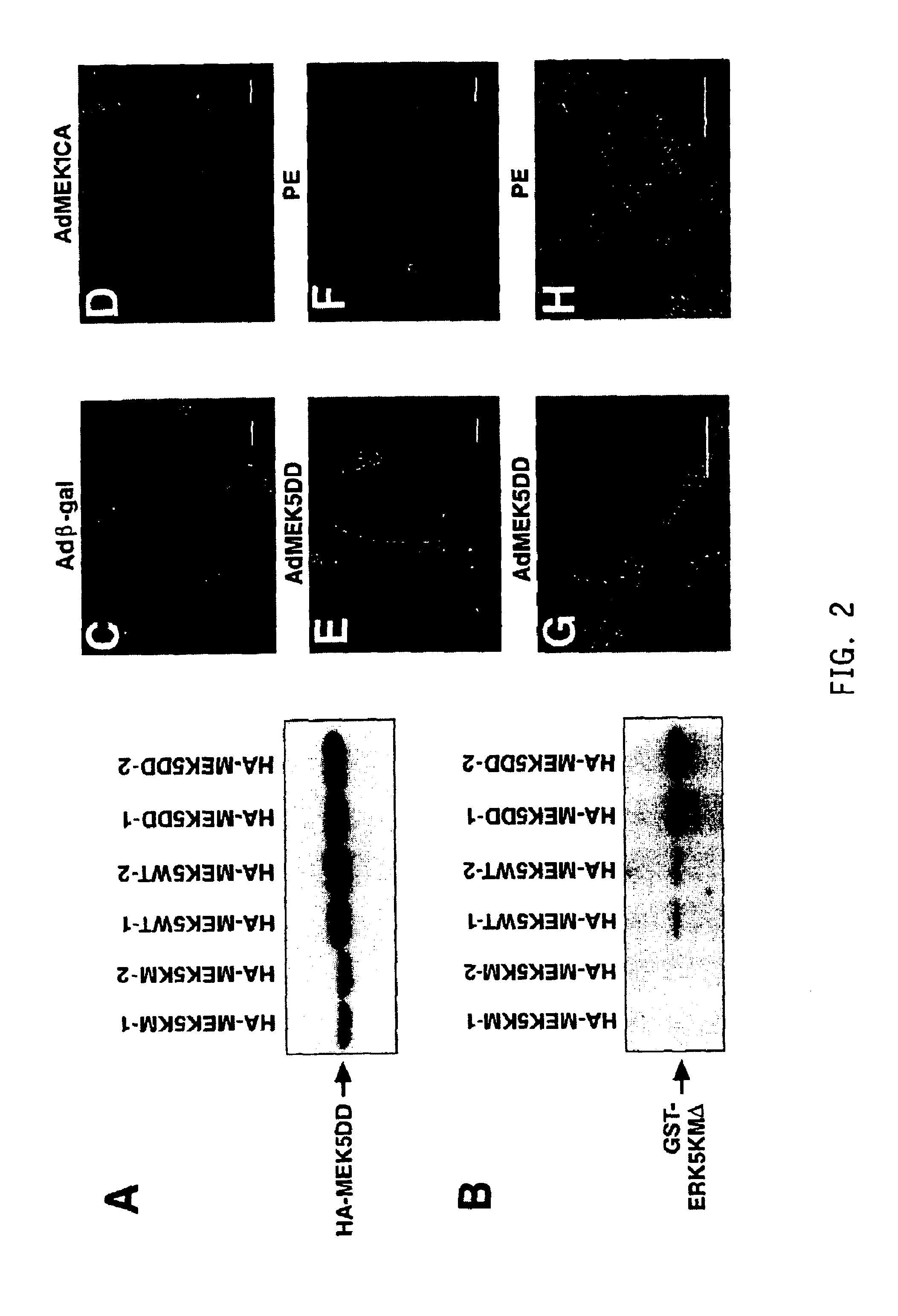 Transgenic mice comprising a constitutively-activated MEK5 and exhibiting cardiac hypertrophy and dilated cardiomyopathy