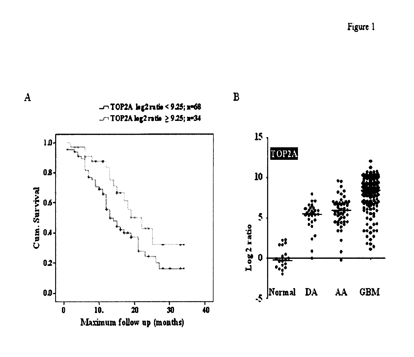 TOP2A inhibition by temozolomide and its predictive value of GBM patients survival