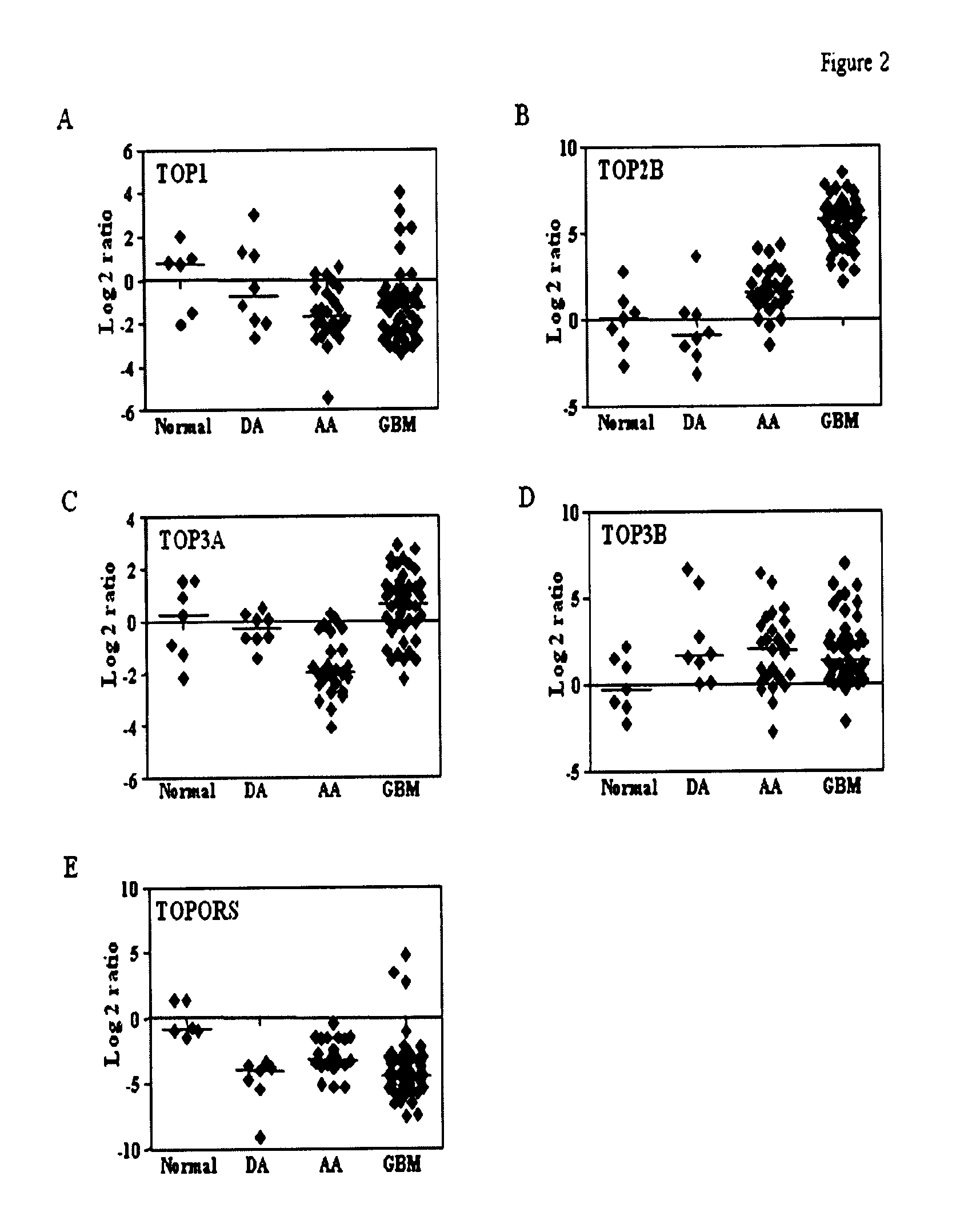 TOP2A inhibition by temozolomide and its predictive value of GBM patients survival