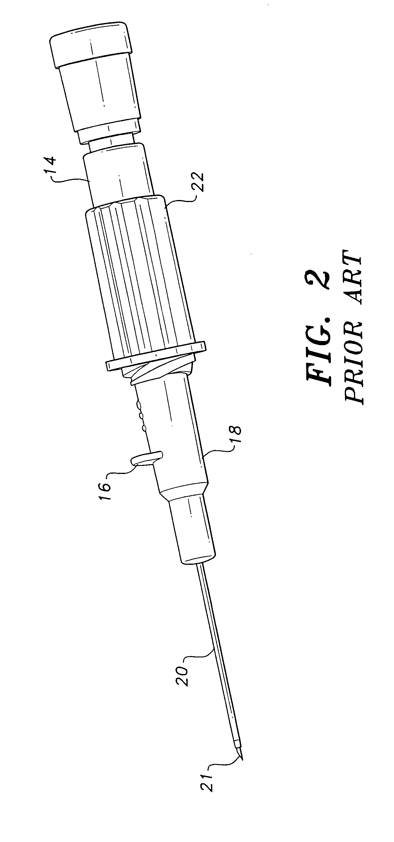 Removable push-off tab for IV catheter