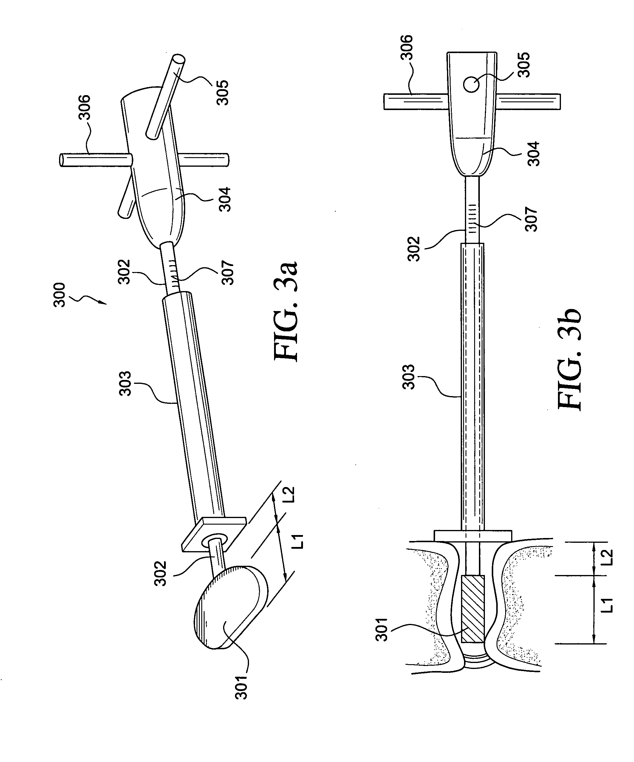 Intervertebral disc replacement and surgical instruments therefor