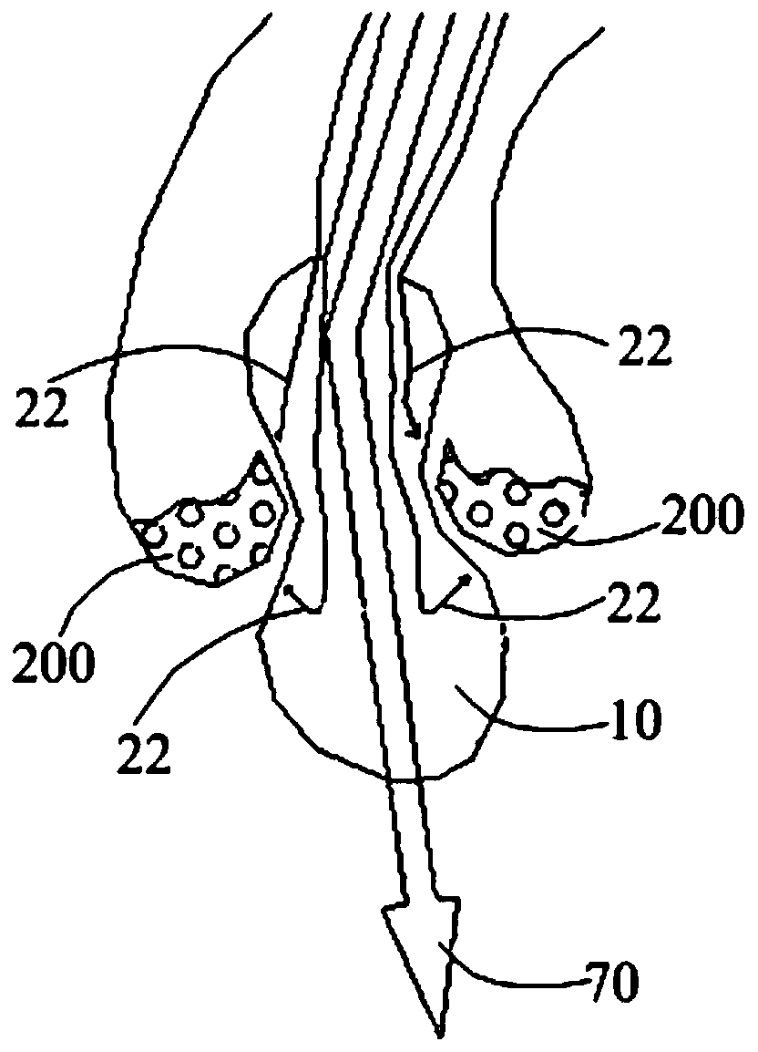 Shock wave device for treating cardiac valve calcification
