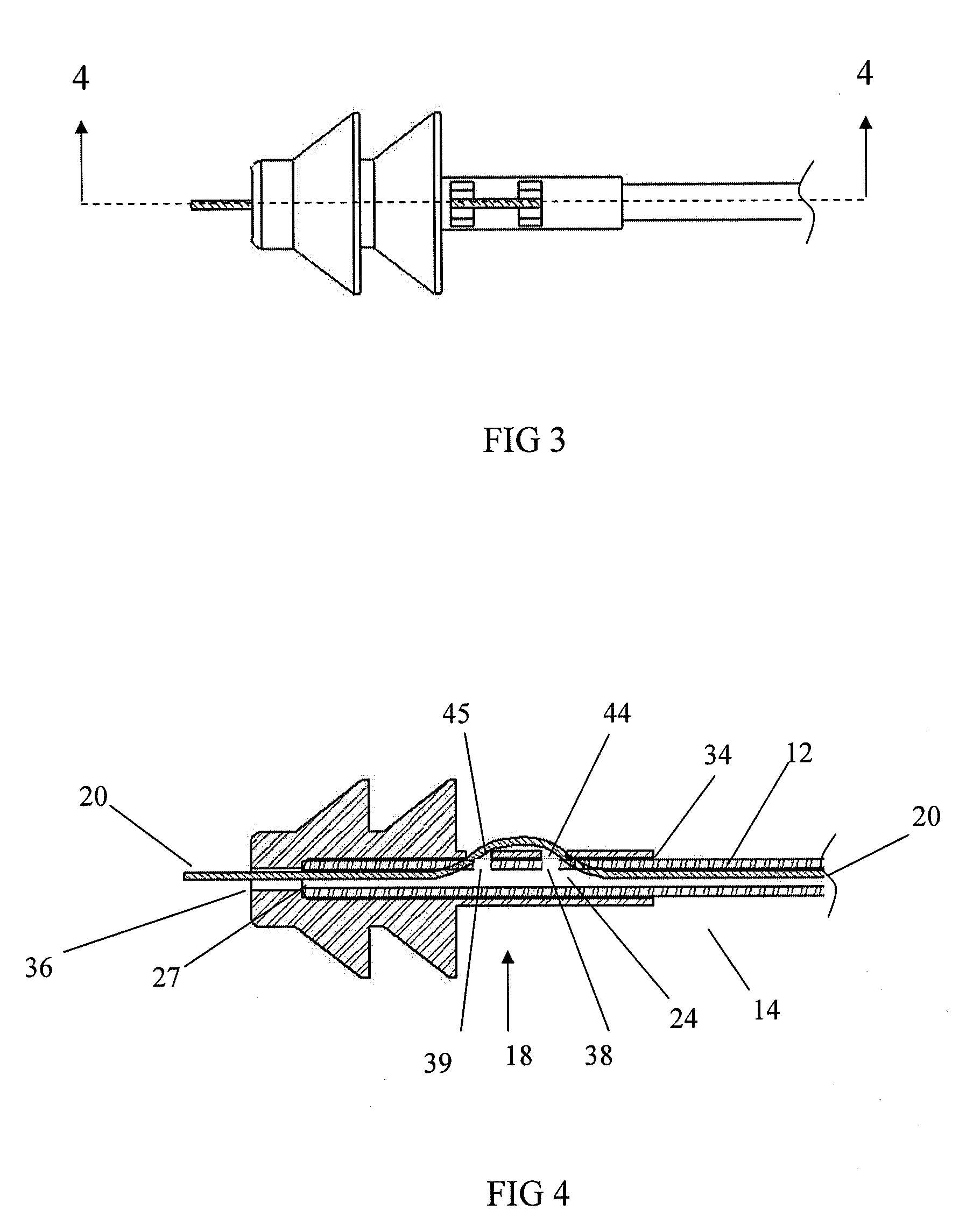 Insertion facilitation device for catheters