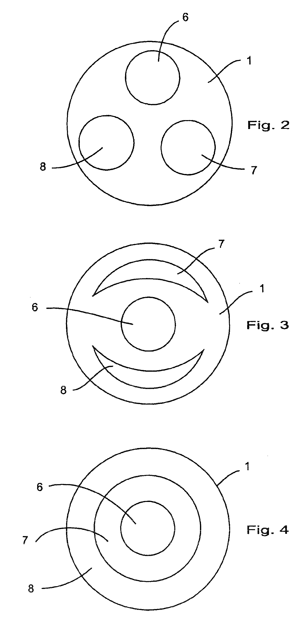 Angioplasty Device