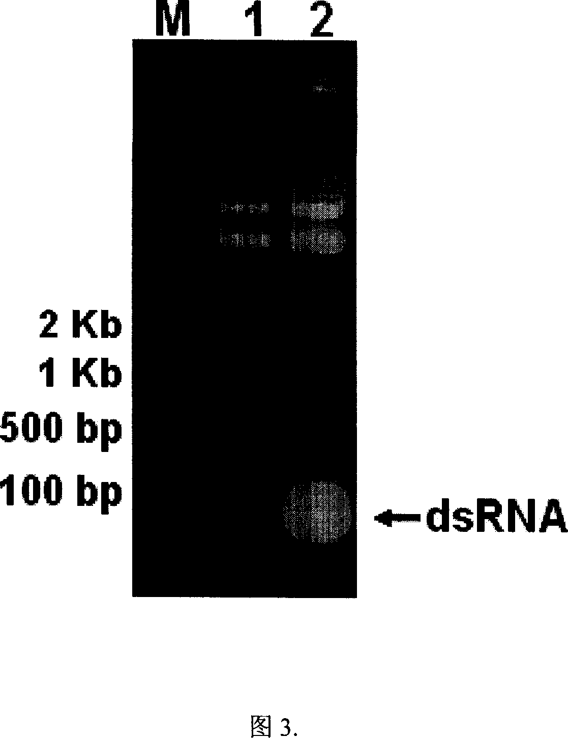 A siRNA capable of preventing and curing hair loss and accelerating hair growth, and preparation method and application thereof