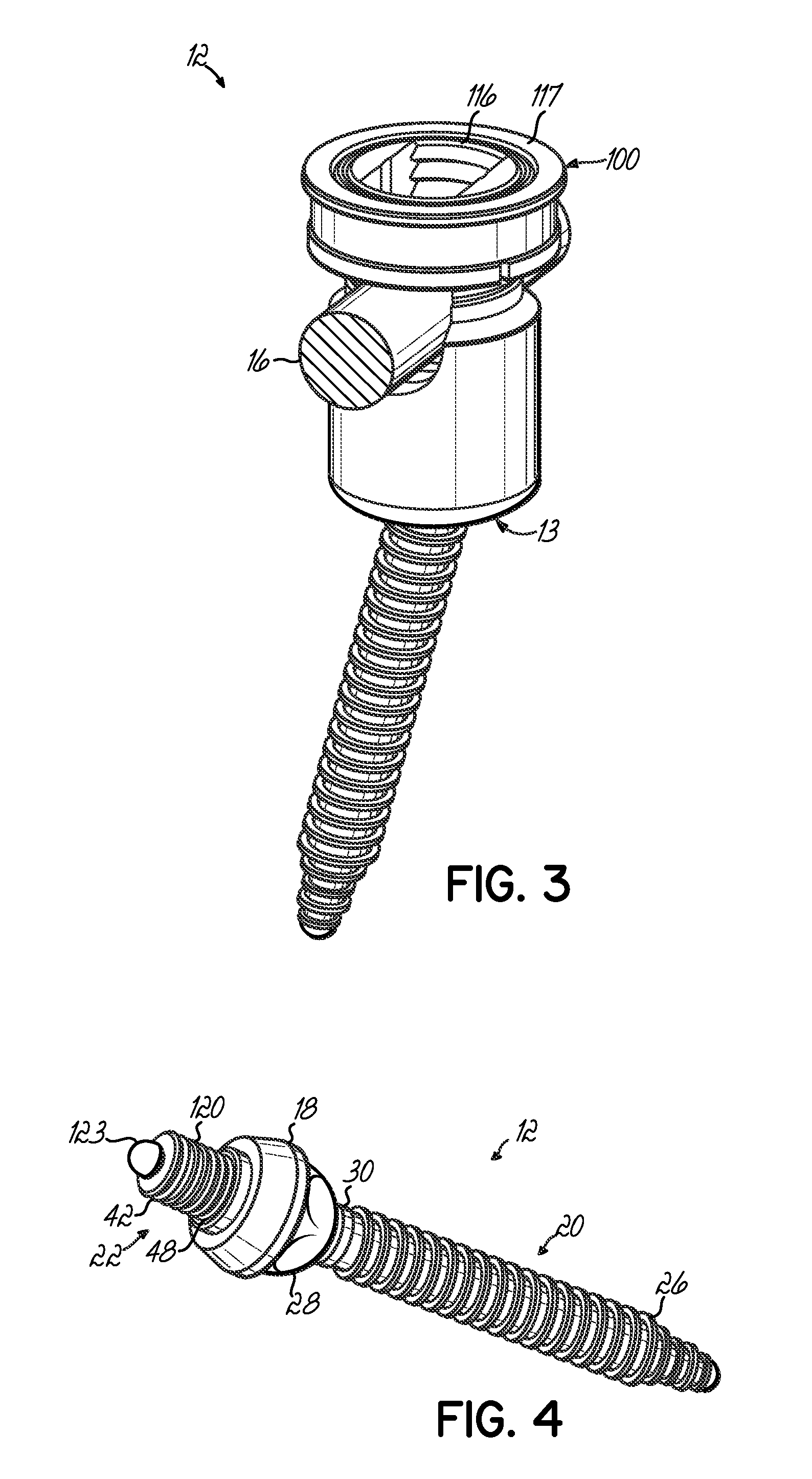 Polyaxial bone screw with torqueless fastening