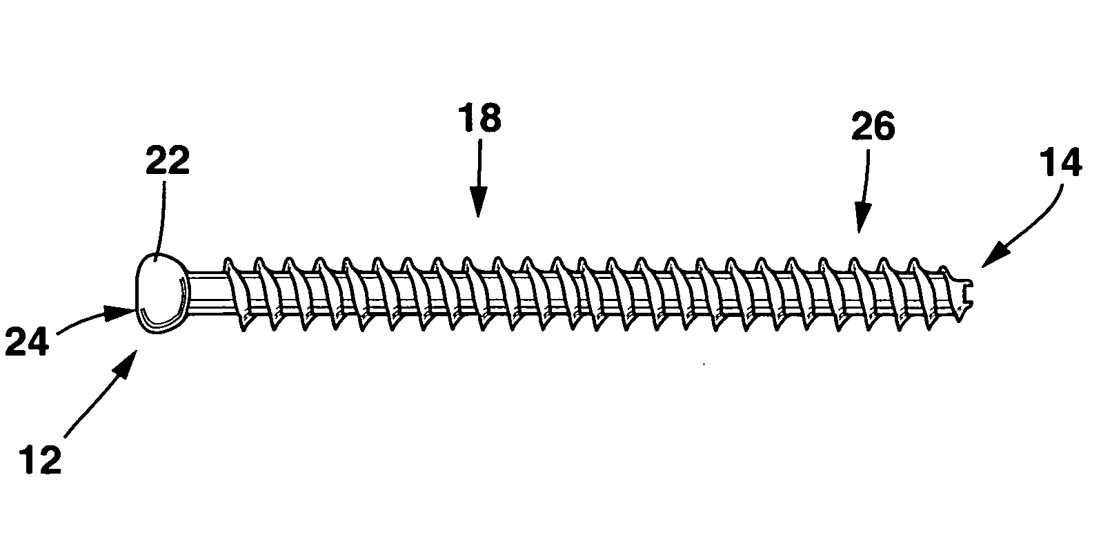 Fortified cannulated screw