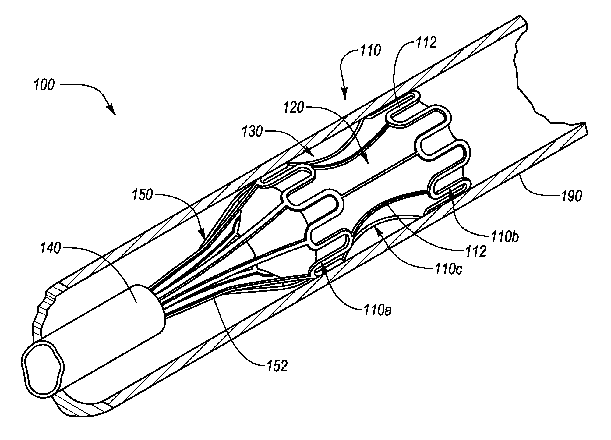 Interluminal medical treatment devices and methods