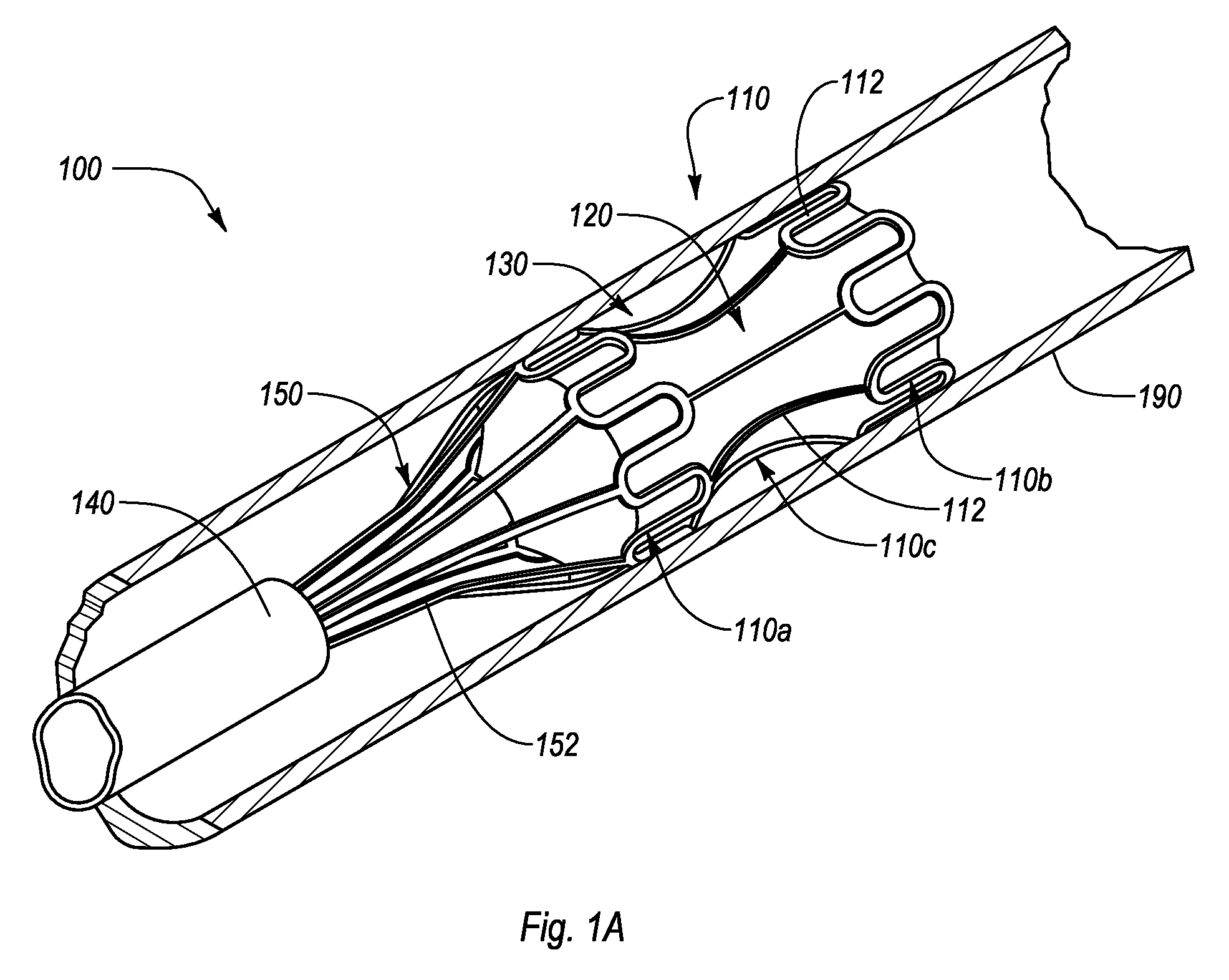 Interluminal medical treatment devices and methods