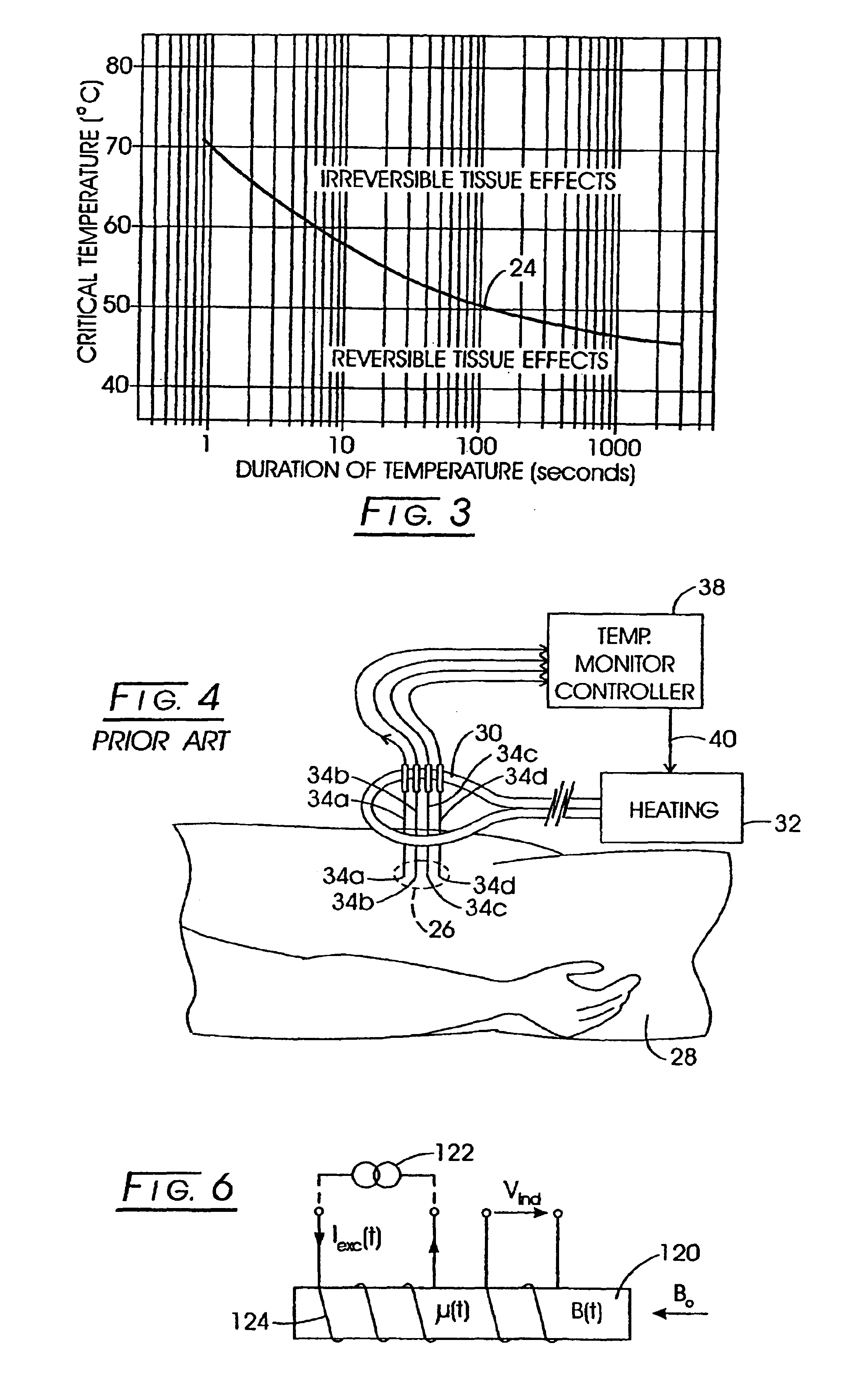System method and apparatus for localized heating of tissue