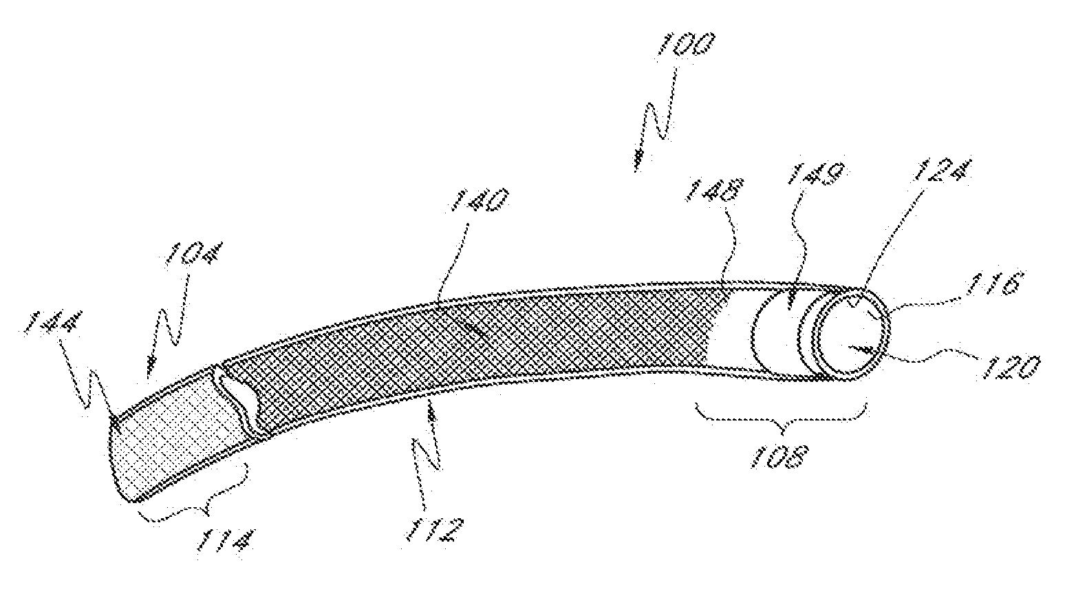 Implantable and removable customizable body conduit