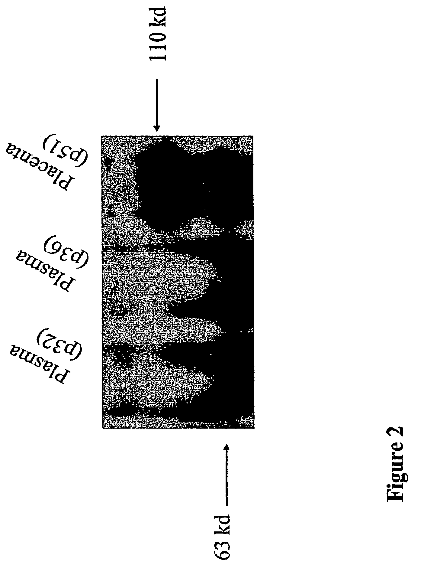 Soluble Endoglin Compounds for the Treatment and Prevention of Cancer