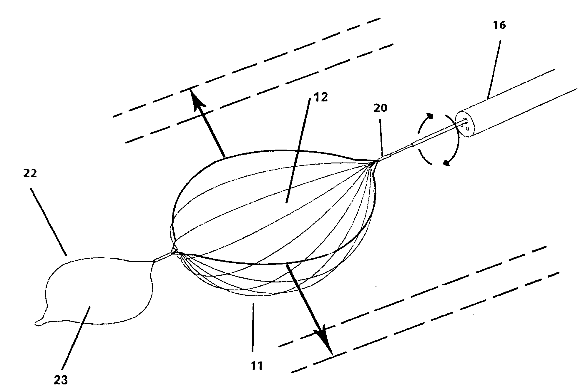 Surgical retrieval device and method