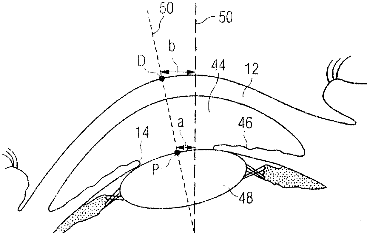 Device, method and control program for ophthalmologic, particularly refractive, laser surgery