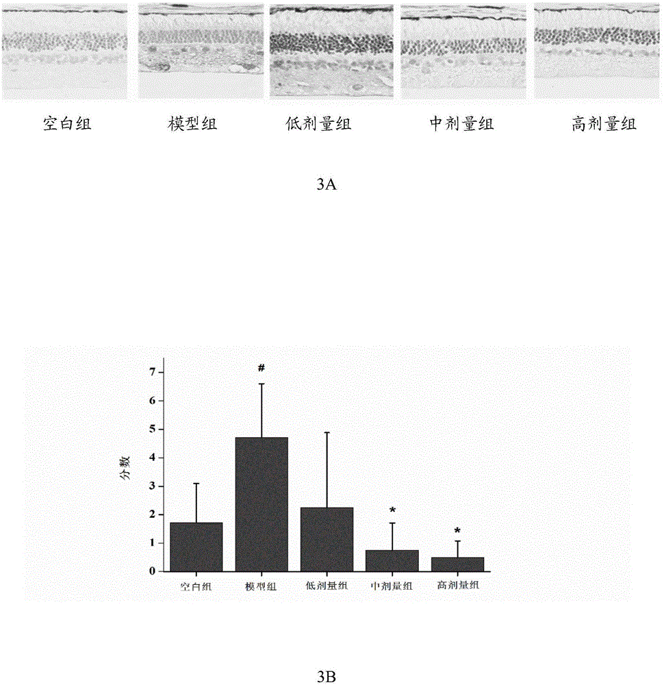 Composition with effects of protecting liver and improving eyesight and preparation method thereof