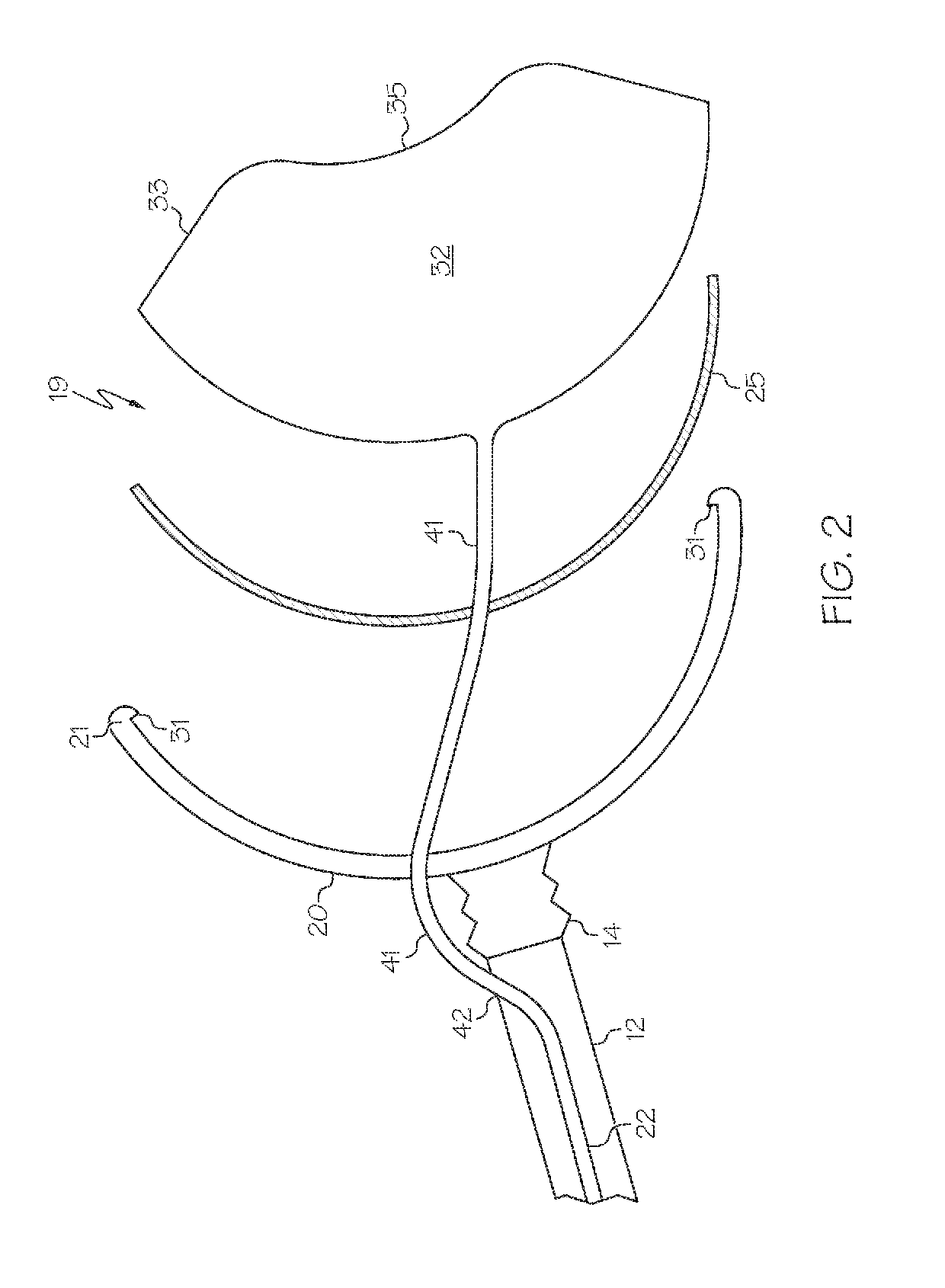 Obstetric apparatus and method