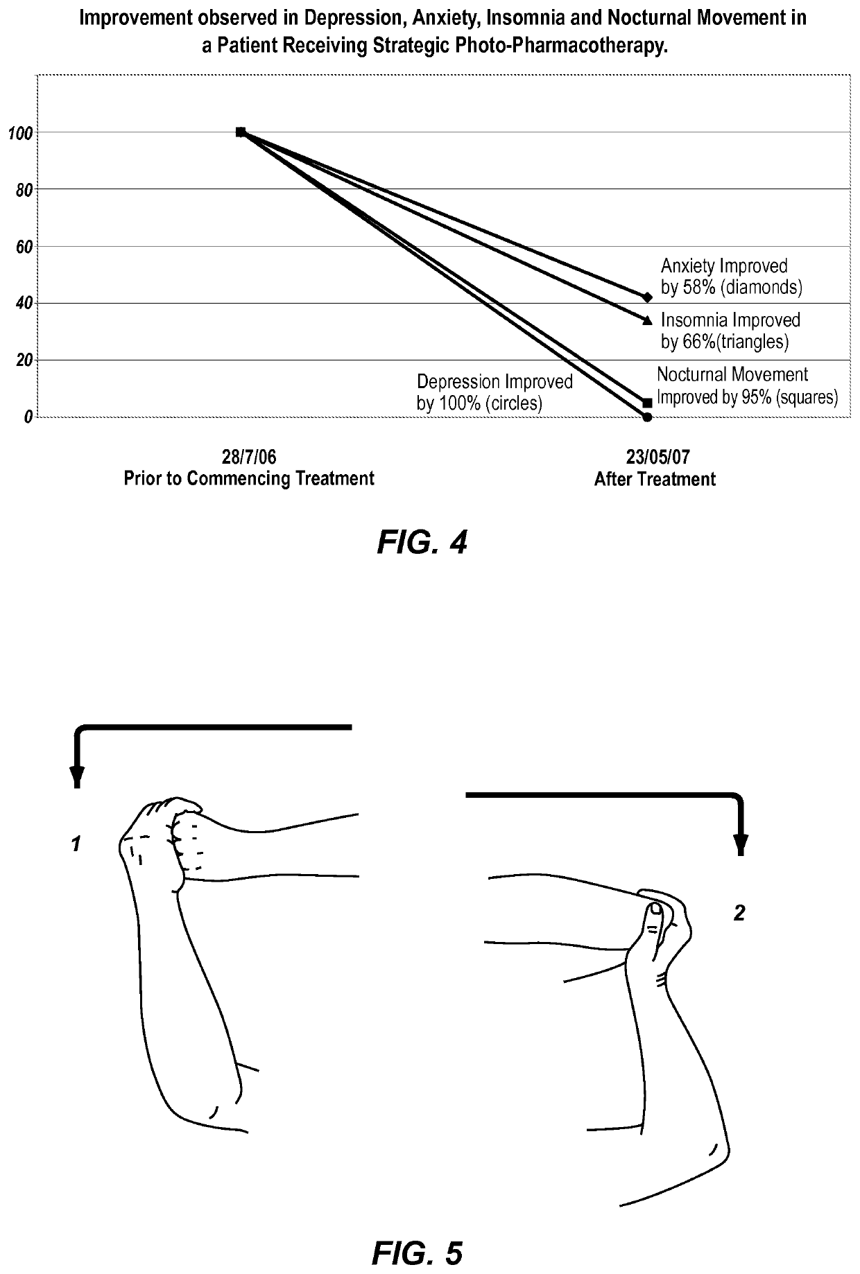 Methods for preventing and treating motor related neurological conditions