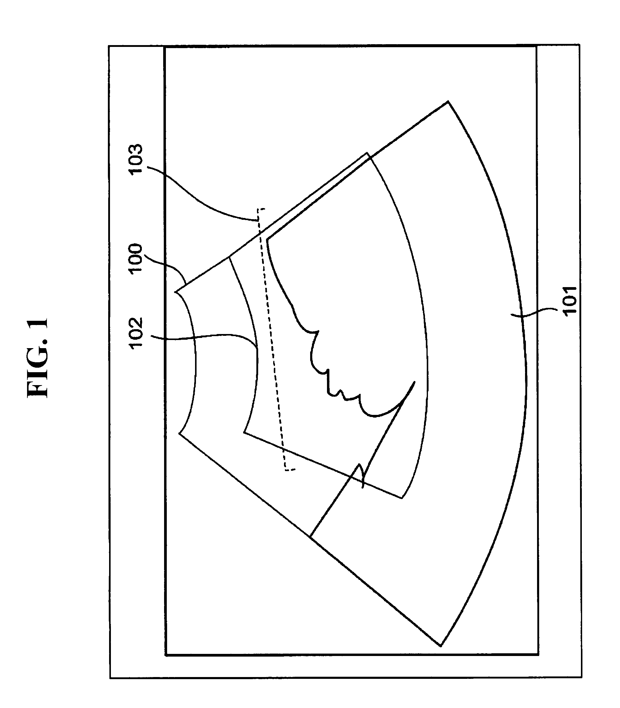 Ultrasound imaging apparatus and method for acquiring ultrasound image
