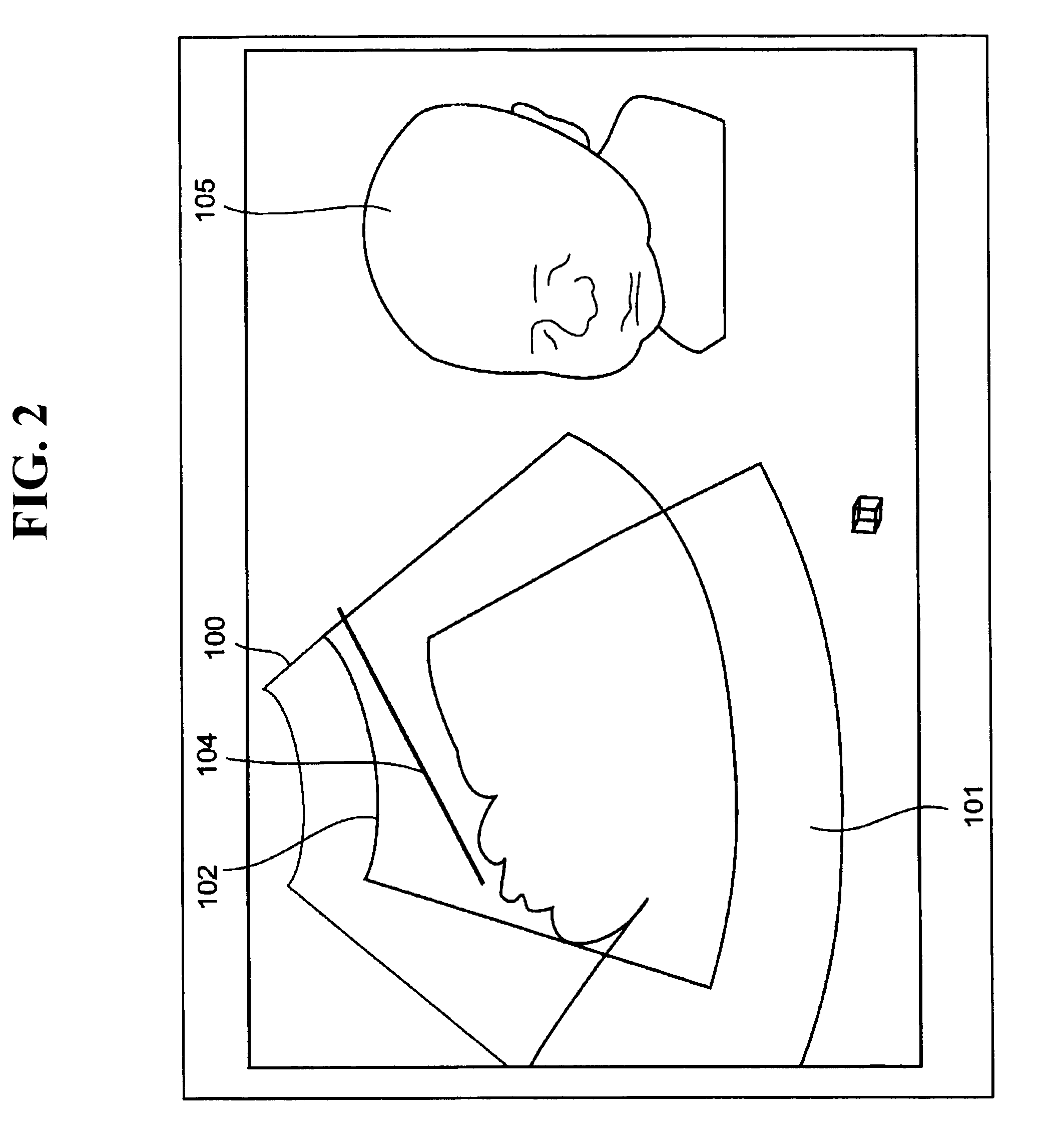 Ultrasound imaging apparatus and method for acquiring ultrasound image