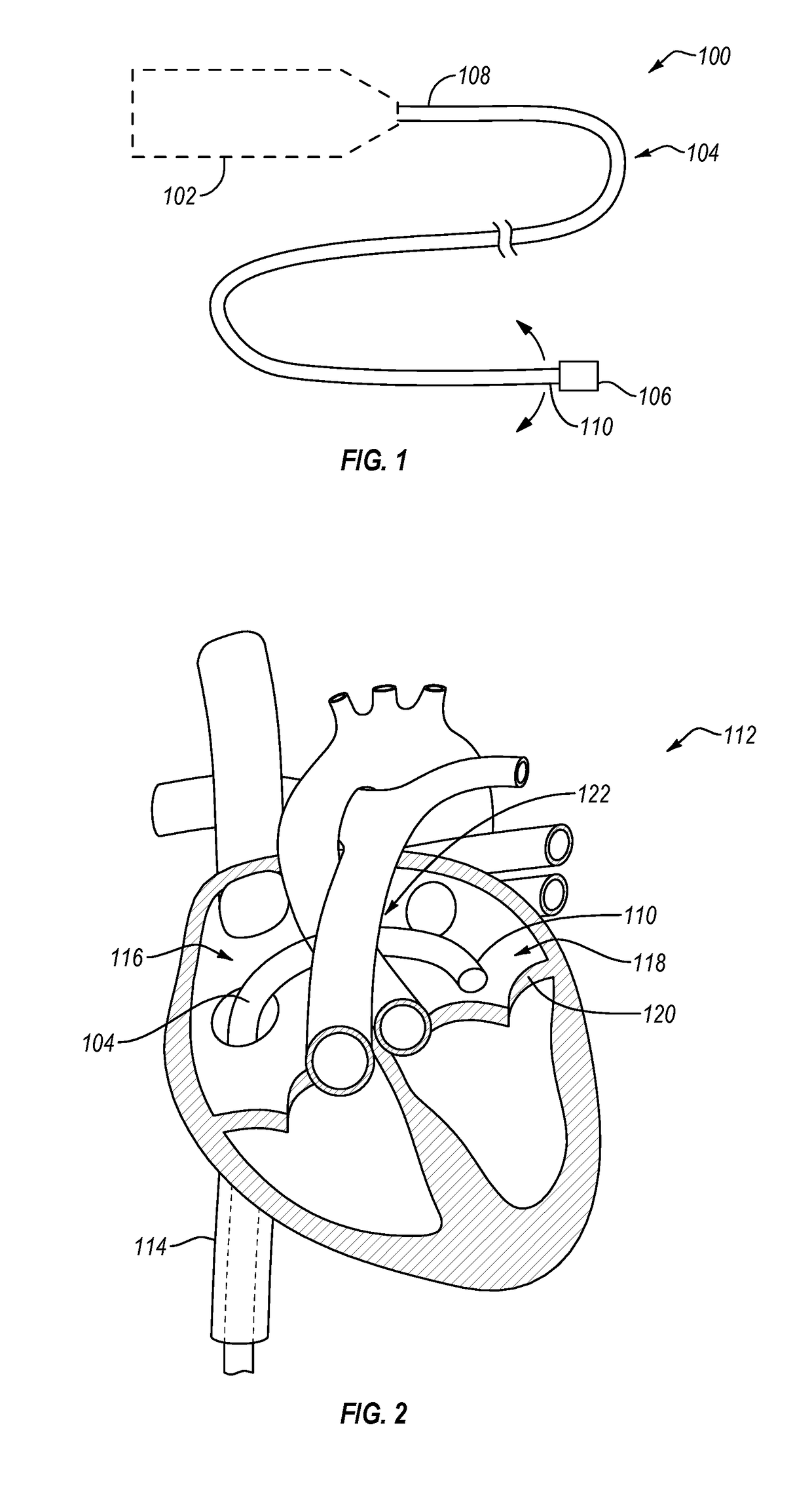 Cardiac implant delivery system