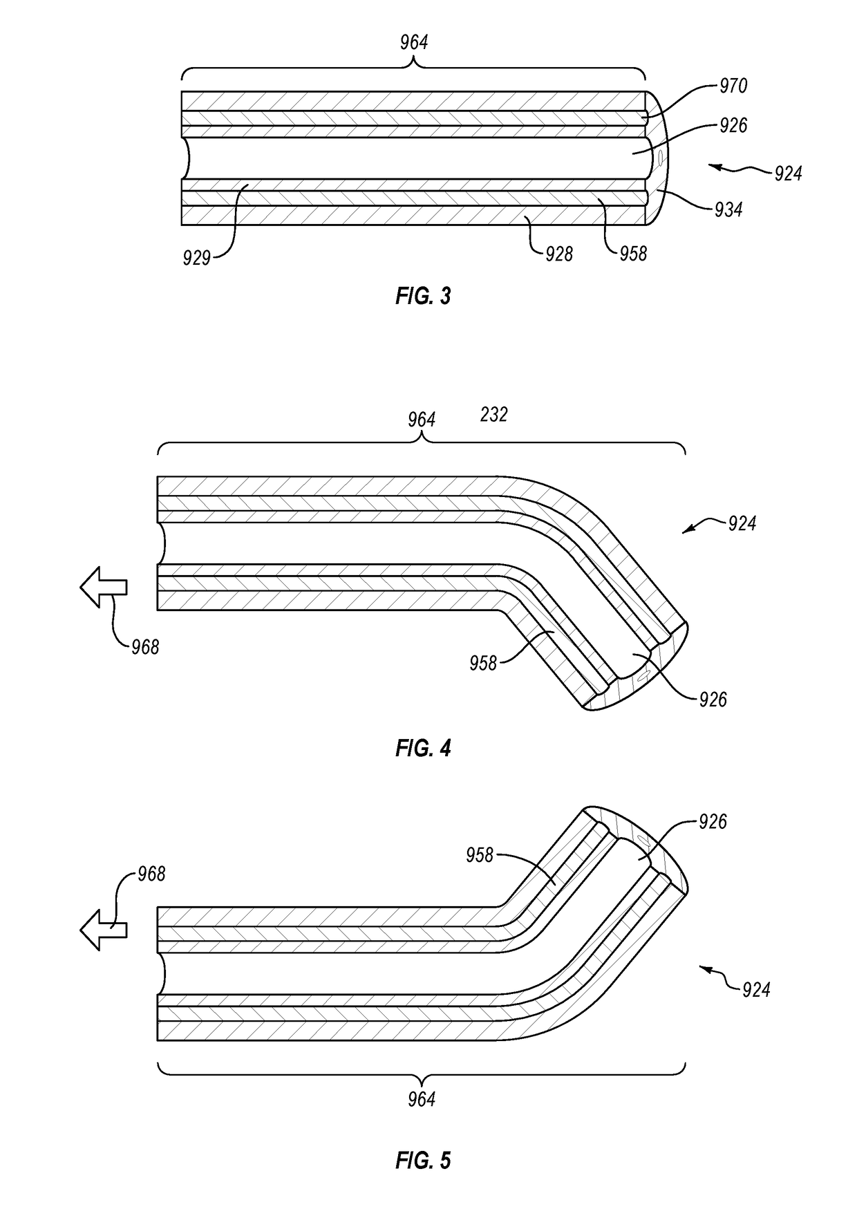 Cardiac implant delivery system