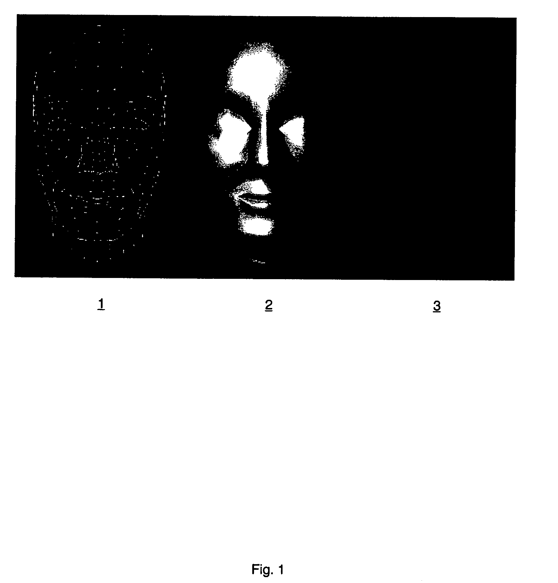Method of animating a synthesised model of a human face driven by an acoustic signal