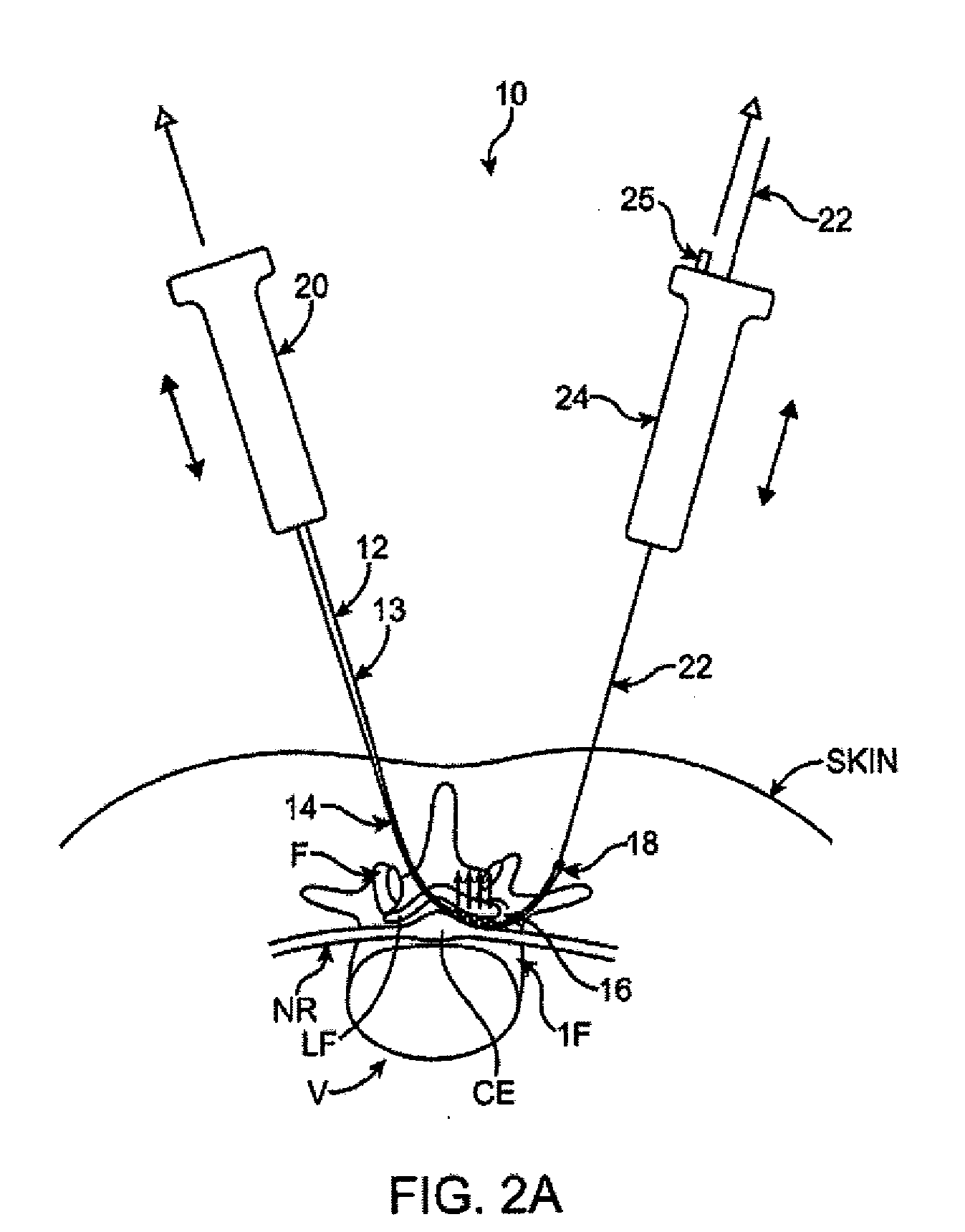 Tissue removal devices and methods