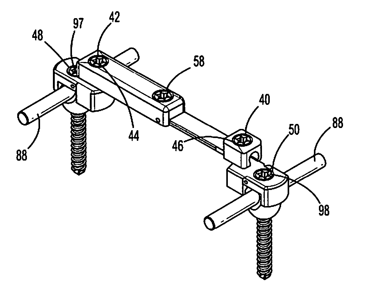 Transverse rod connector