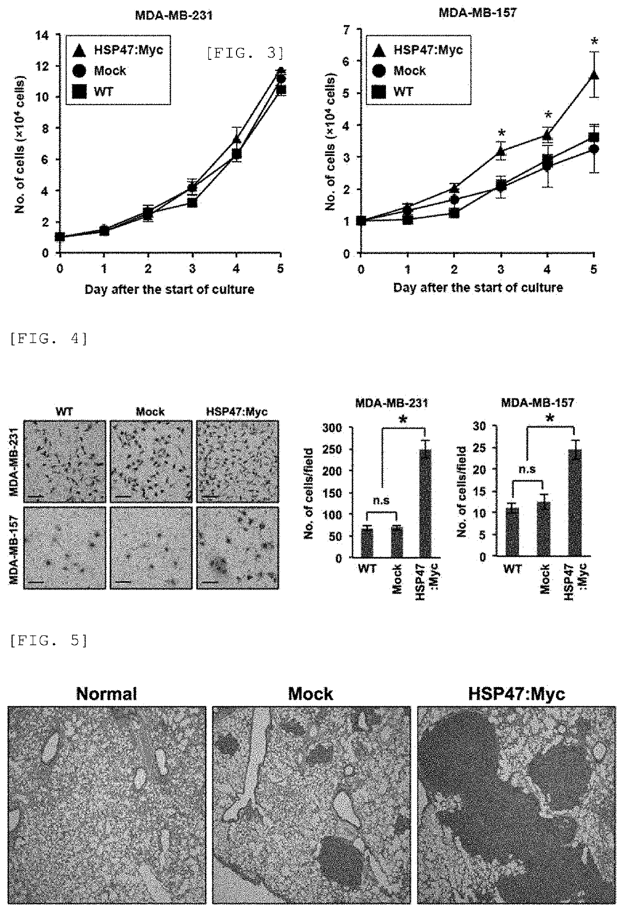 Agent using hsp47 inhibitor to suppress metastasis