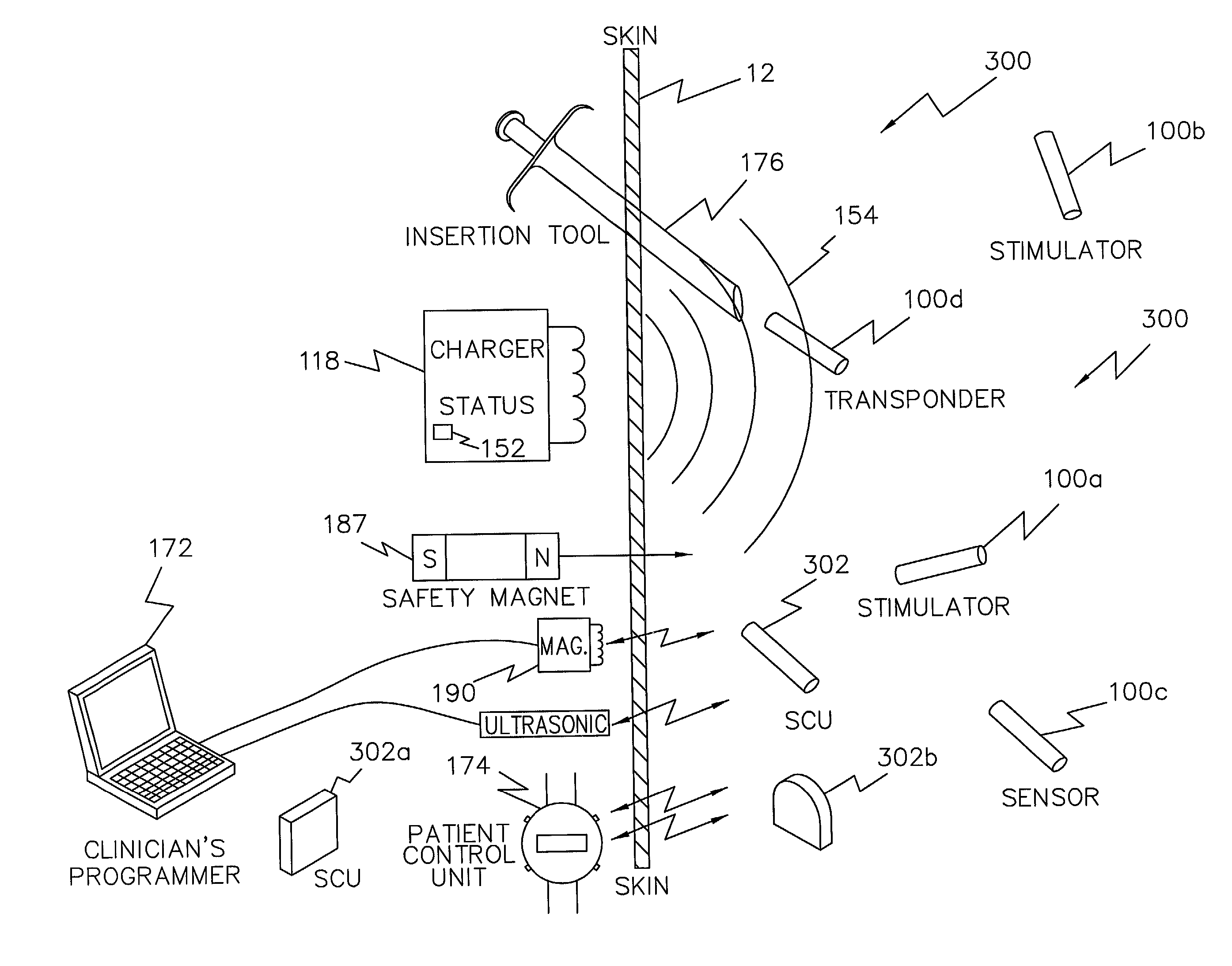 Pulsed magnetic control system for interlocking functions of battery powered living tissue stimulators
