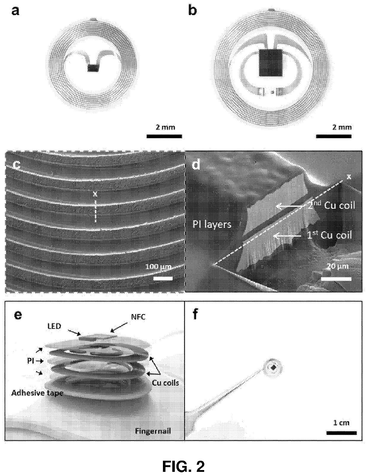 Miniaturized electronic systems with wireless power and near-field communication capabilities