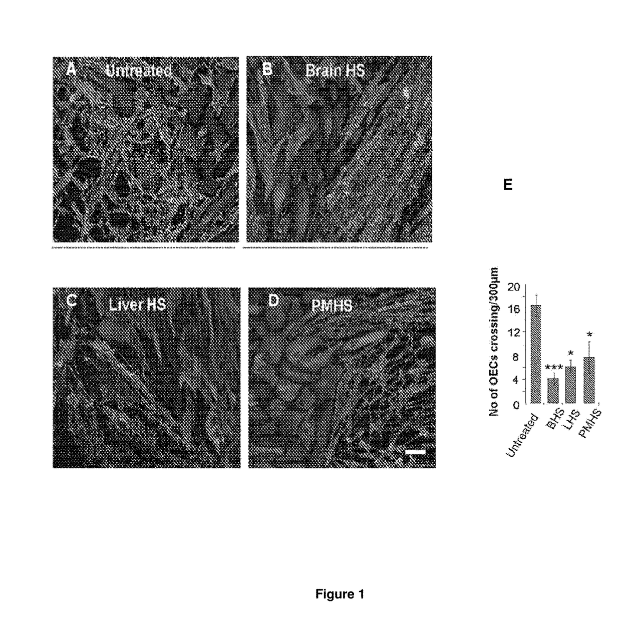 Agents for the prevention and/or treatment of central nervous system damage