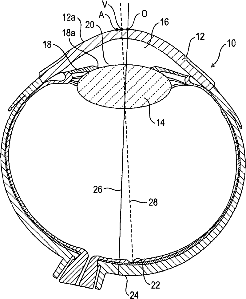Device for refractive surgery